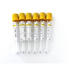 Usage médical jetable 9,5 ml Tubes de collecte d&#39;urine PET avec capuchon en caoutchouc